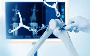 robotik-diz-protezi-ameliyati