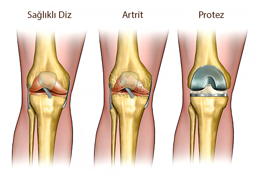 diz-selcuk