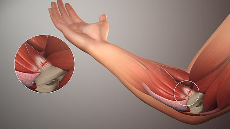 tendon-onarimi
